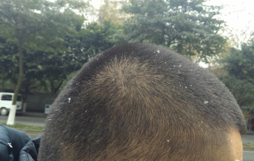 2016成都下雪1